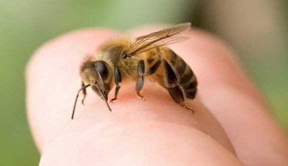 Bee Stings